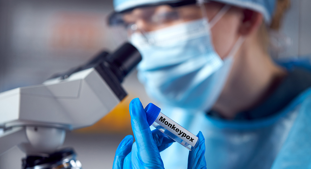 masked up doctor looking through microscope while holding vial labeled monkeypox