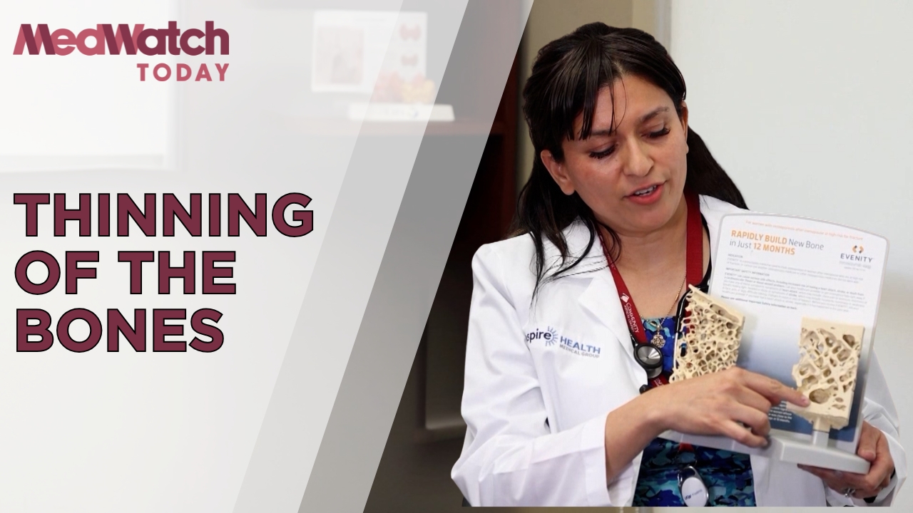 Interview of the Week: Women and Osteoporosis