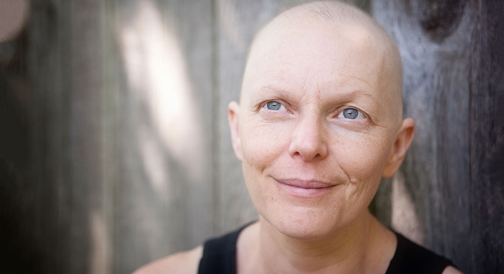A white woman with a bald head smiles