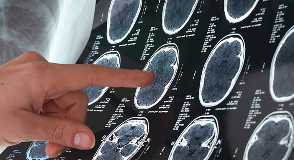 A white hand points at a scan showing multiple human brain images